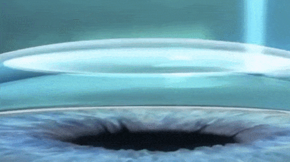 微信图片_20260120094025.gif